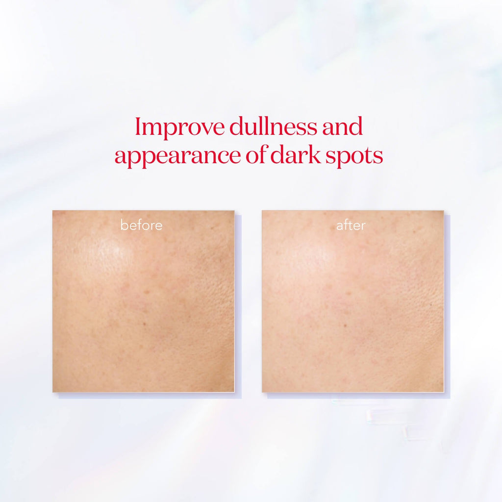 GenOptics InfinitAura Serum