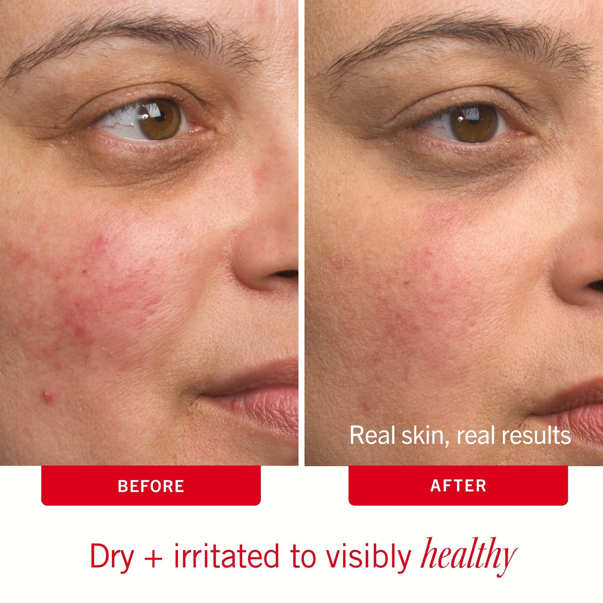 Ultra Repair Cream Fresh Strawberry