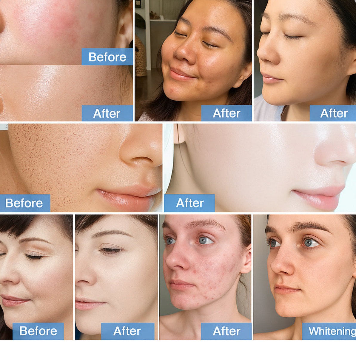 Classic Glow Facial + LED Light Therapy