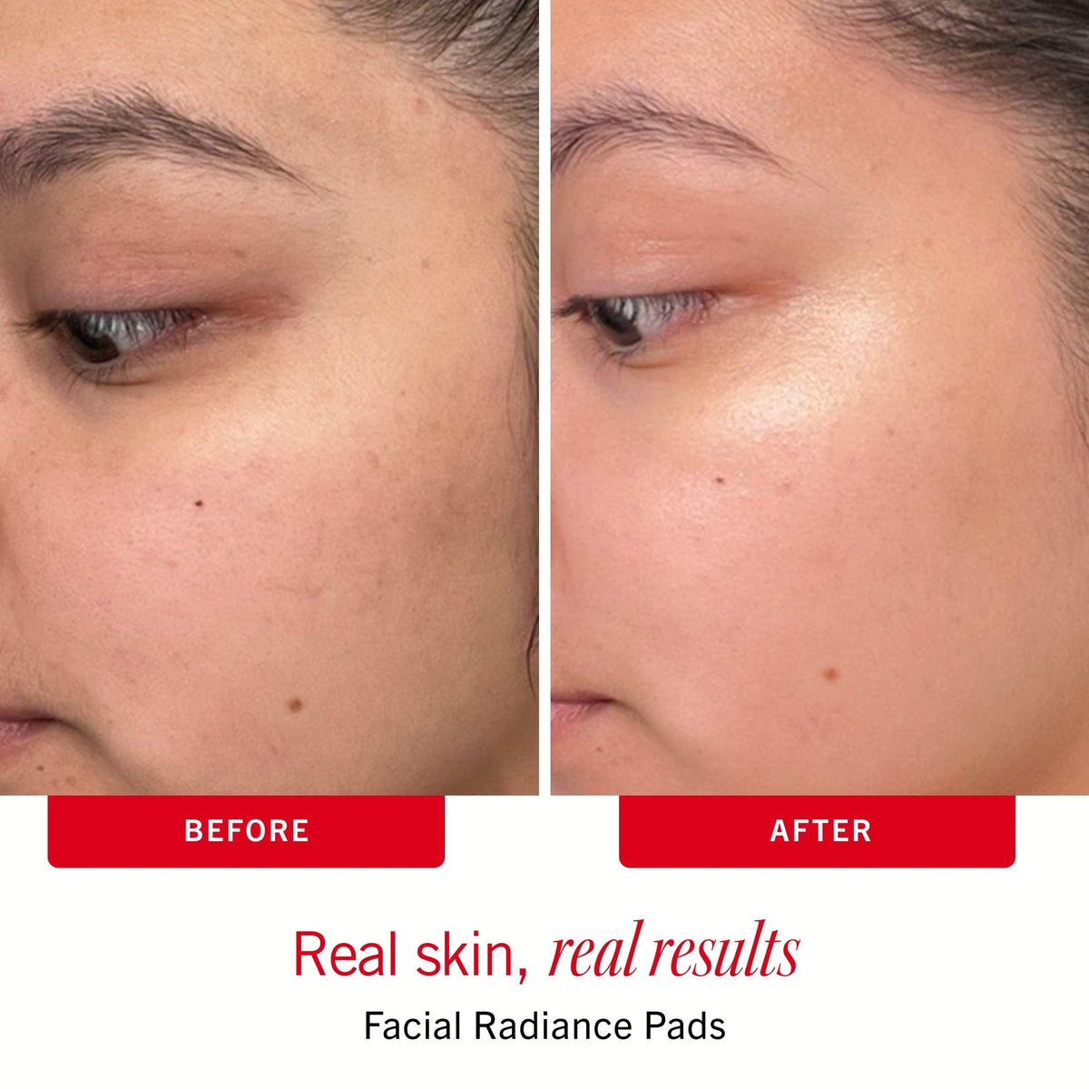 Sensitive Skin Bestsellers