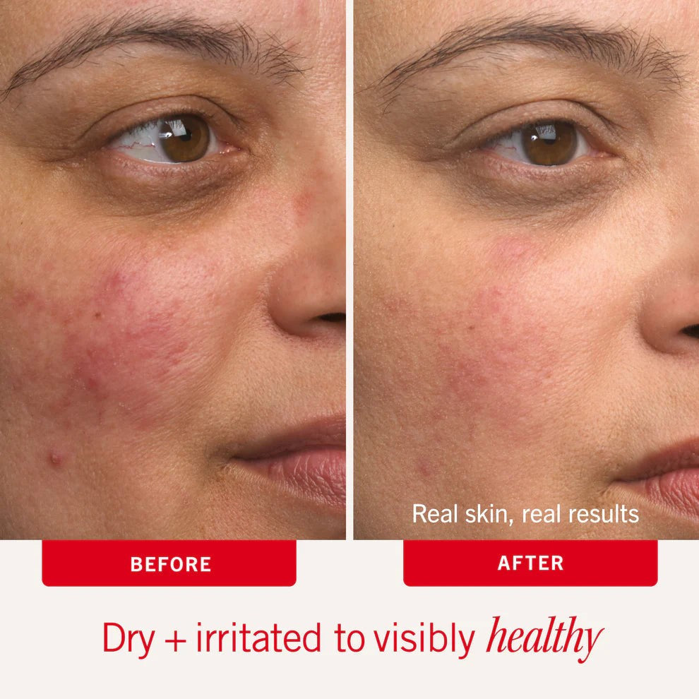 Dry Skin Duo