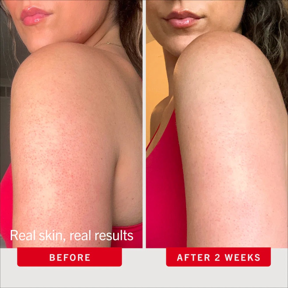 Beach Day Skin Bundle